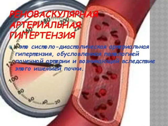 РЕНОВАСКУЛЯРНАЯ АРТЕРИАЛЬНАЯ ГИПЕРТЕНЗИЯ - это систоло-диастолическая артериальная гипертензия, обусловленная патологией почечной артерии и