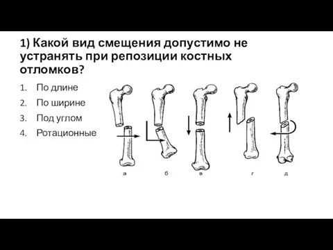 1) Какой вид смещения допустимо не устранять при репозиции костных