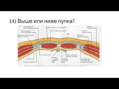 14) Выше или ниже пупка?