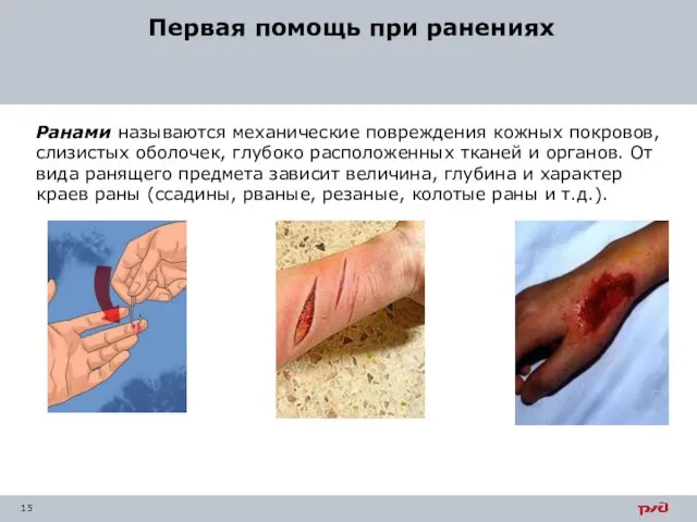 Ранами называются механические повреждения кожных покровов, слизистых оболочек, глубоко расположенных