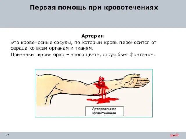 Первая помощь при кровотечениях Артерии Это кровеносные сосуды, по которым