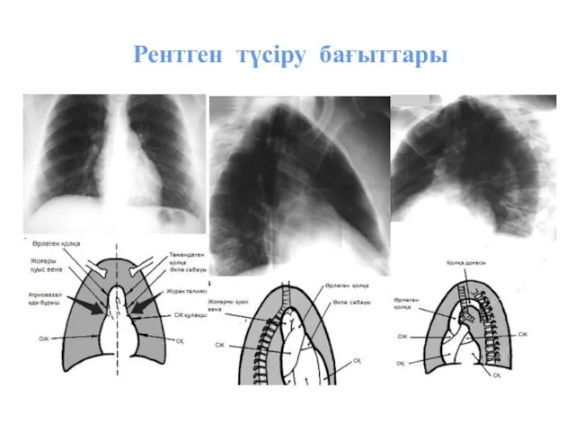 Рентген түсіру бағыттары