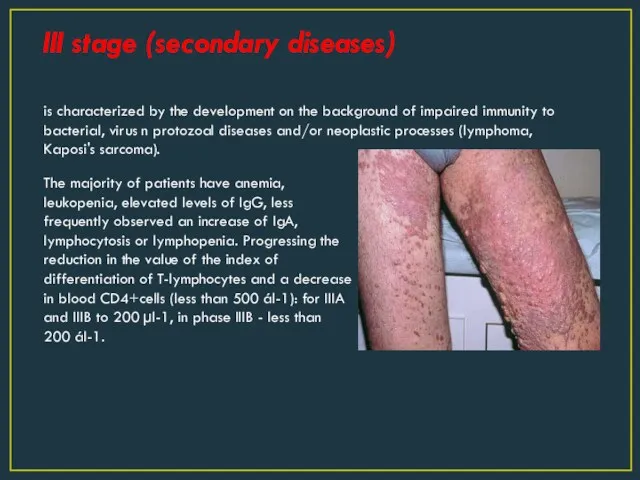 III stage (secondary diseases) is characterized by the development on