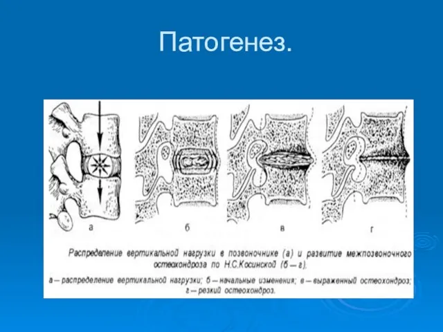 Патогенез.