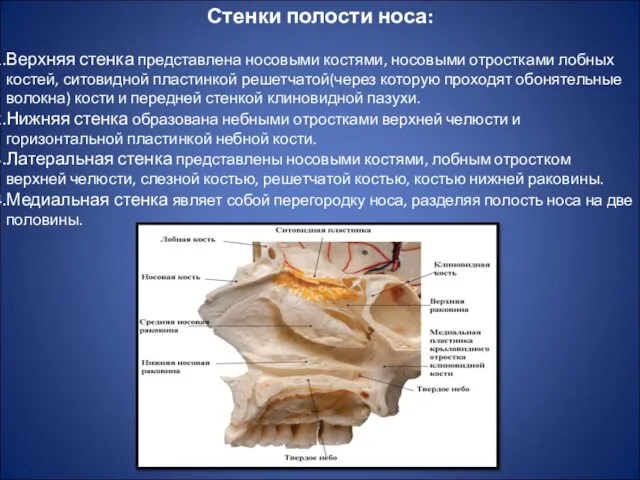 Стенки полости носа: Верхняя стенка представлена носовыми костями, носовыми отростками