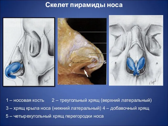 Скелет пирамиды носа 1 2 3 4 5 1 2