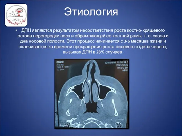 Этиология ДПН являются результатом несоответствия роста костно-хрящевого остова перегородки носа