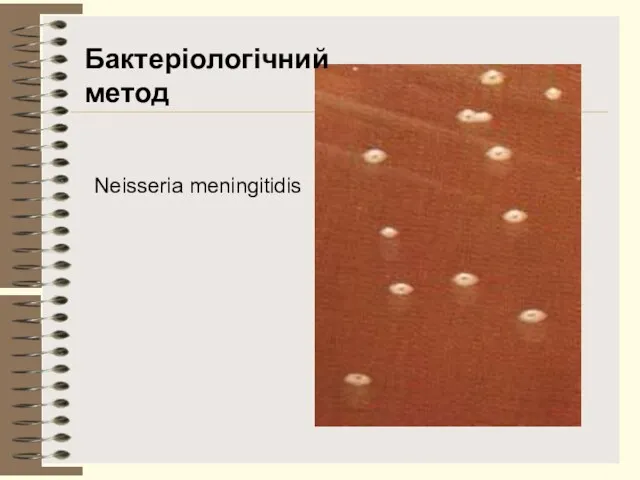 Neisseria meningitidis Бактеріологічний метод