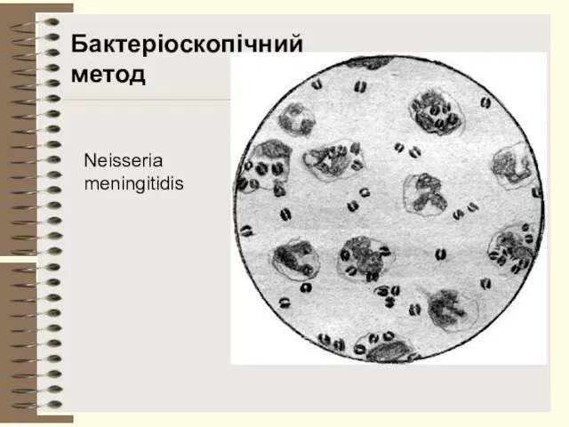 Neisseria meningitidis Бактеріоскопічний метод