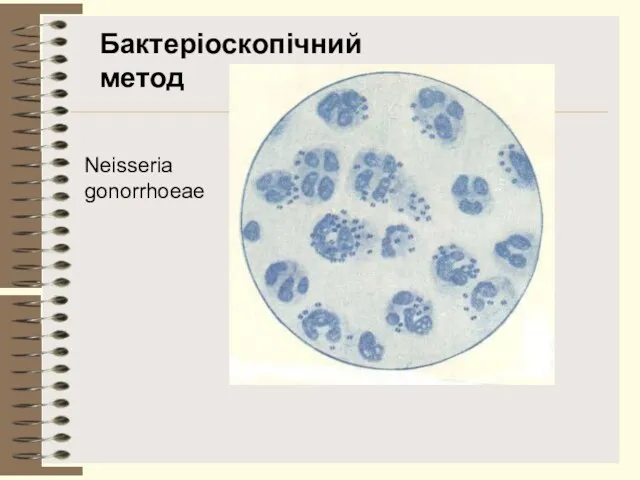 Neisseria gonorrhoeae Бактеріоскопічний метод