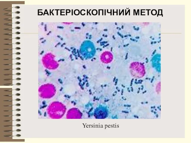 БАКТЕРІОСКОПІЧНИЙ МЕТОД Yersinia pestis