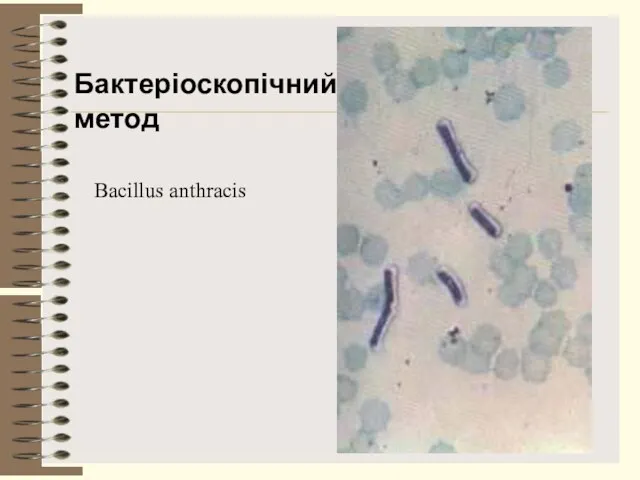 Bacillus anthracis Бактеріоскопічний метод