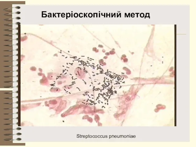 Бактеріоскопічний метод Streptococcus pneumoniae