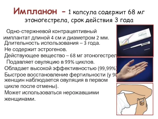 Импланон - 1 капсула содержит 68 мг этоногестрела, срок действия