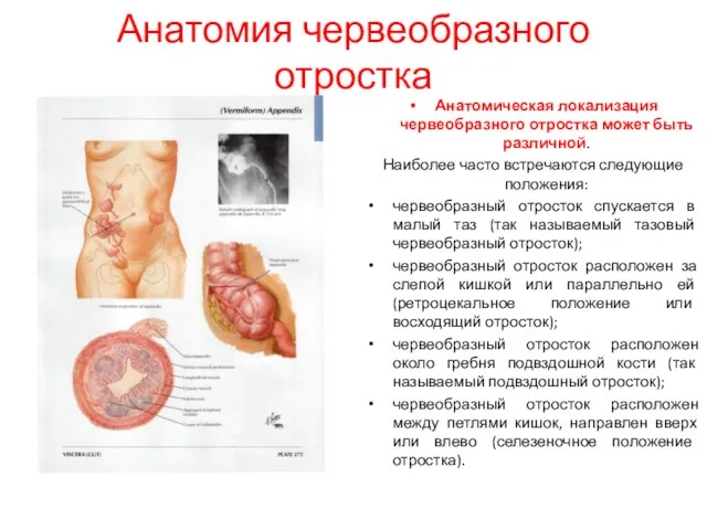 Анатомия червеобразного отростка Анатомическая локализация червеобразного отростка может быть различной.