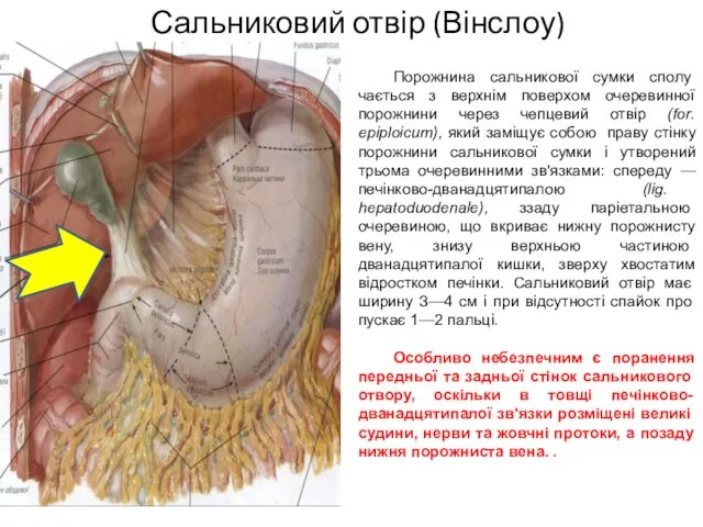 Сальниковий отвір (Вінслоу) Порожнина сальникової сумки сполу­чається з верхнім поверхом