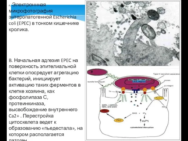 A. Электроннная микрофотография энтеропатогенной Escherichia coli (EPEC) в тонком кишечнике кролика. B. Начальная