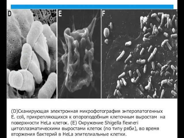 (D)Сканирующая электронная микрофотография энтеропатогенных Е. coli, прикрепляющихся к опороподобным клеточным выростам на поверхности