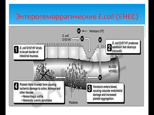 Энтерогеморрагические E.coli (EHEC)