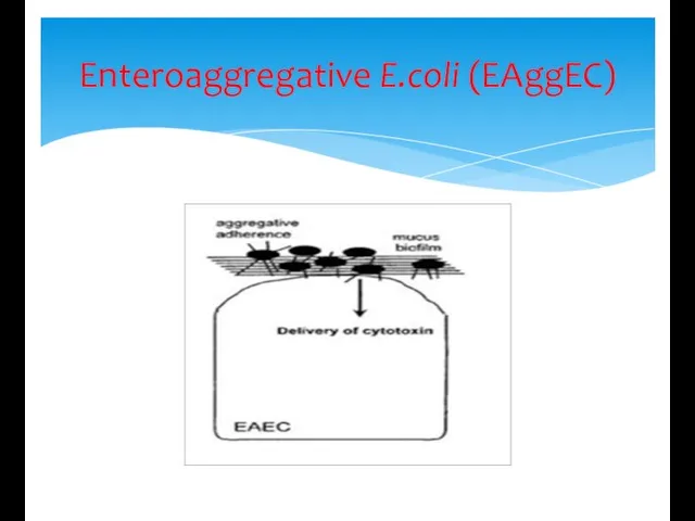 Enteroaggregative E.coli (EAggEC)