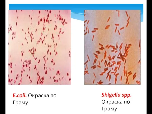E.coli. Окраска по Граму Shigella spp. Окраска по Граму