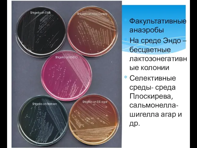 Факультативные анаэробы На среде Эндо – бесцветные лактозонегативные колонии Селективные