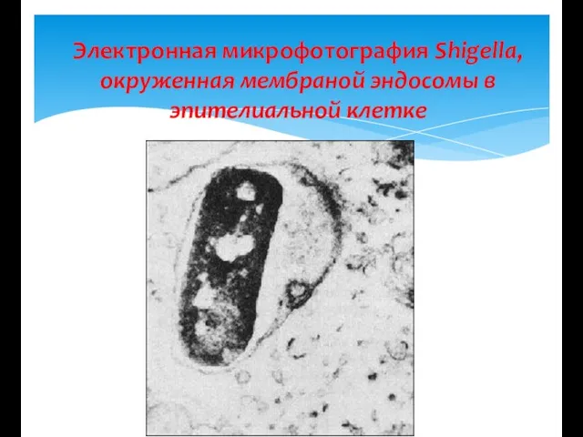 Электронная микрофотография Shigella, окруженная мембраной эндосомы в эпителиальной клетке