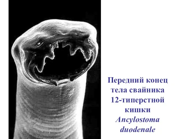 Передний конец тела свайника 12-типерстной кишки Ancylostoma duodenale