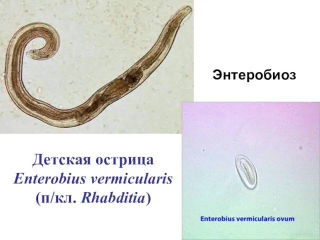 Детская острица Enterobius vermicularis (п/кл. Rhabditia) Энтеробиоз