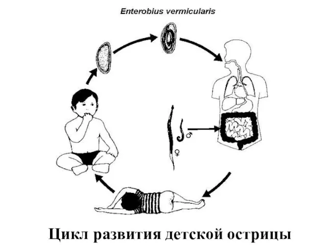 Цикл развития детской острицы