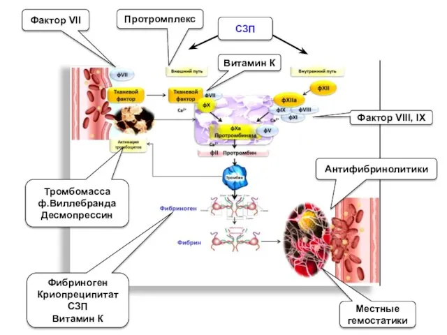 Фактор VII Фибриноген Криопреципитат СЗП Витамин К Протромплекс Тромбомасса ф.Виллебранда