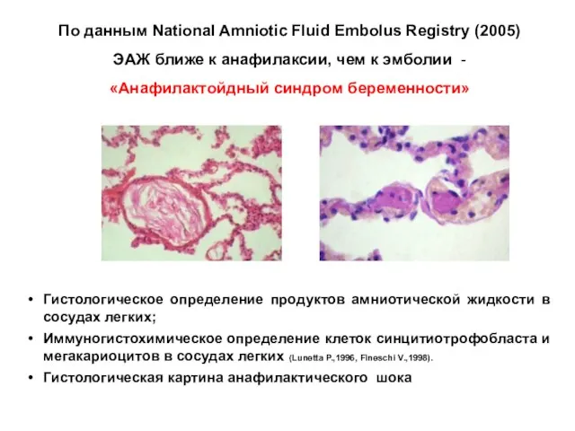 По данным National Amniotic Fluid Embolus Registry (2005) ЭАЖ ближе