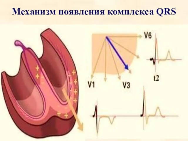 Механизм появления комплекса QRS