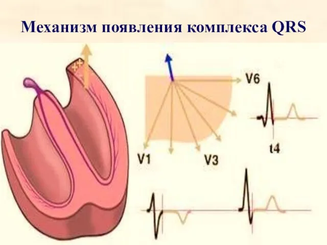 Механизм появления комплекса QRS