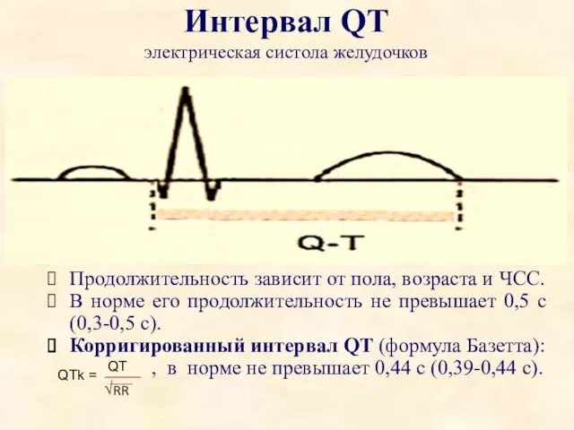 Интервал QT электрическая систола желудочков Продолжительность зависит от пола, возраста