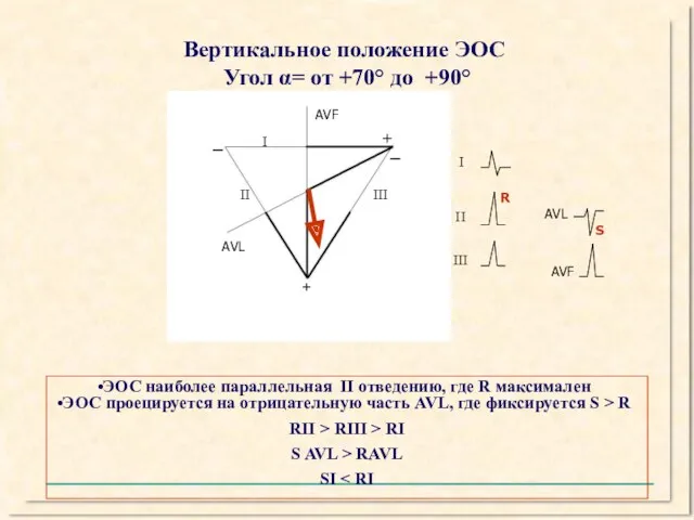 Вертикальное положение ЭОС Угол α= от +70° до +90° I