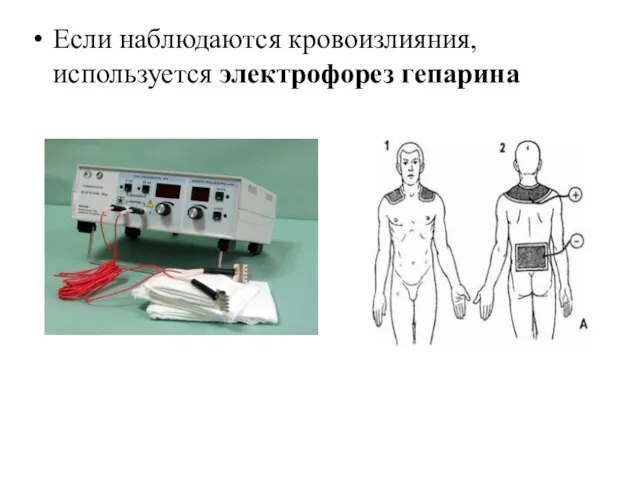 Если наблюдаются кровоизлияния, используется электрофорез гепарина