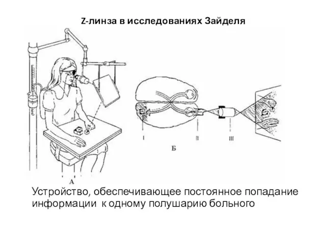 Z-линза в исследованиях Зайделя Устройство, обеспечивающее постоянное попадание информации к одному полушарию больного