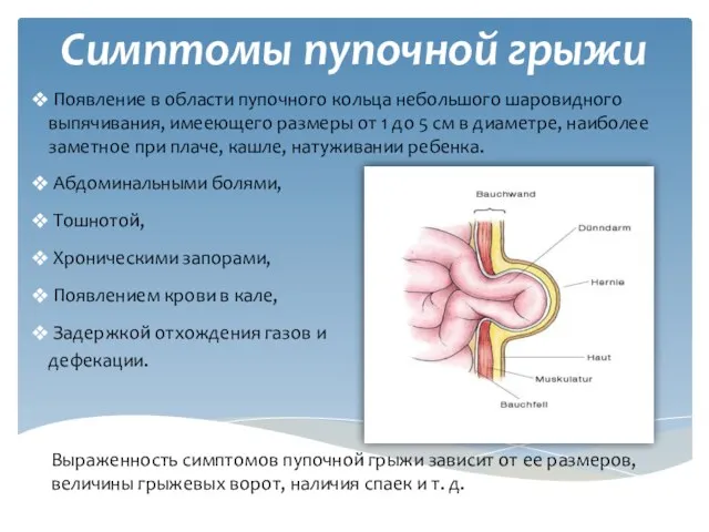 Симптомы пупочной грыжи Появление в области пупочного кольца небольшого шаровидного