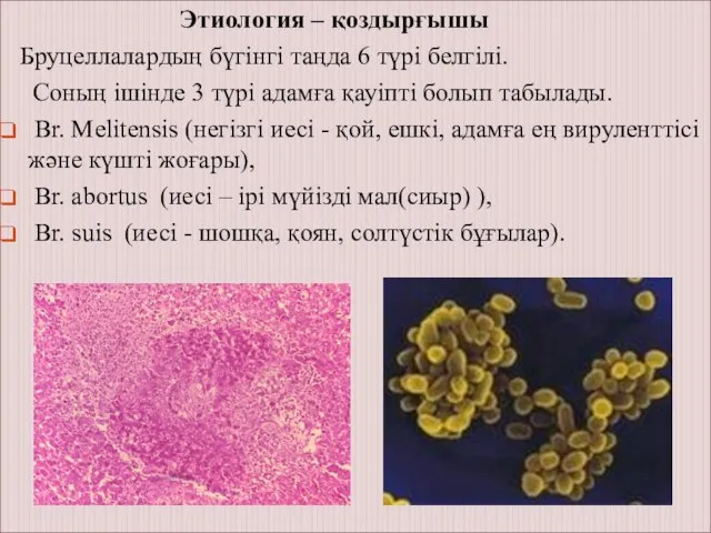 Этиология – қоздырғышы Бруцеллалардың бүгінгі таңда 6 түрі белгілі. Соның