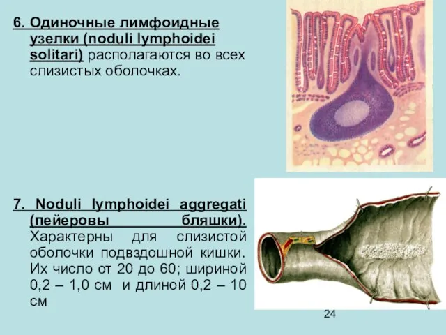 6. Одиночные лимфоидные узелки (noduli lymphoidei solitari) располагаются во всех
