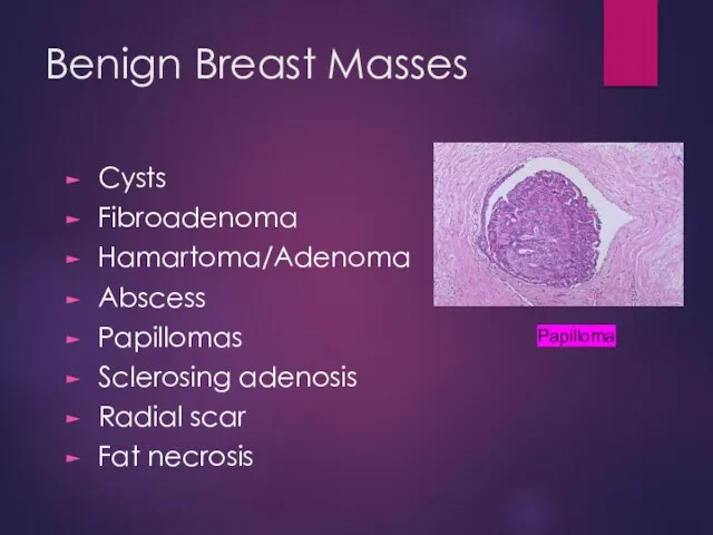 Benign Breast Masses Cysts Fibroadenoma Hamartoma/Adenoma Abscess Papillomas Sclerosing adenosis Radial scar Fat necrosis Papilloma