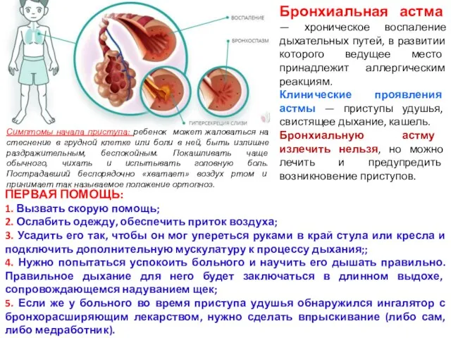 Бронхиальная астма — хроническое воспаление дыхательных путей, в развитии которого ведущее место принадлежит