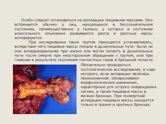 Особо следует остановиться на аспирации пищевыми массами. Оно встречается обычно