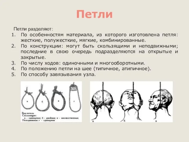 Петли Петли разделяют: По особенностям материала, из которого изготовлена петля: жесткие, полужесткие, мягкие,