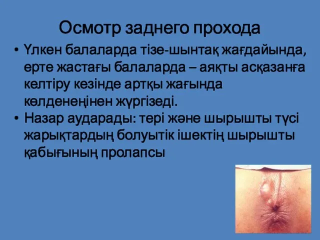 Осмотр заднего прохода Үлкен балаларда тізе-шынтақ жағдайында, ерте жастағы балаларда