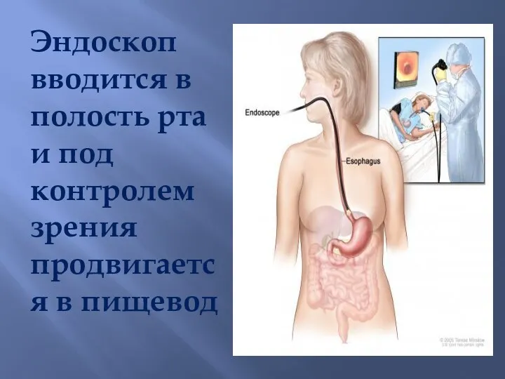 Эндоскоп вводится в полость рта и под контролем зрения продвигается в пищевод