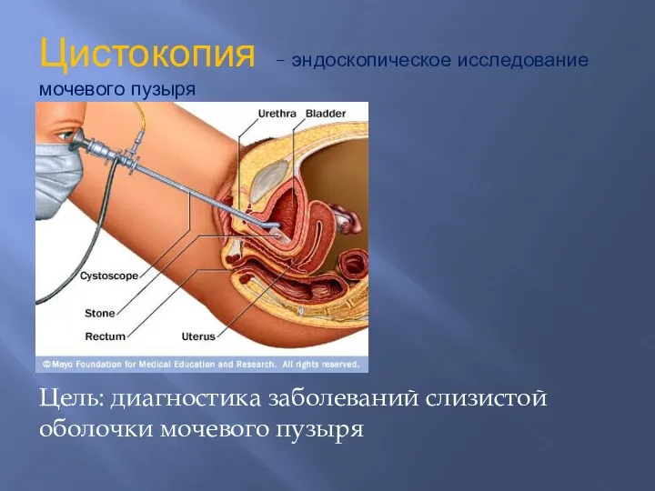 Цистокопия – эндоскопическое исследование мочевого пузыря Цель: диагностика заболеваний слизистой оболочки мочевого пузыря