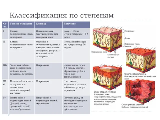 Классификация по степеням