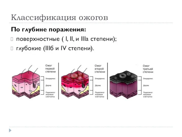 Классификация ожогов По глубине поражения: поверхностные ( I, II, и